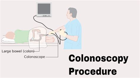 colonoscopy bag covers|colonoscopy biopsy procedure.